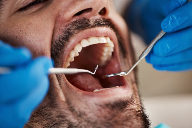 Best Urgent Care for Lost Fillings or Crowns in Oasis, CA